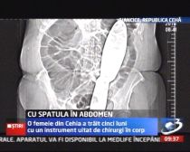 Radiografie