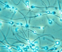 spermatozoizi