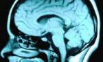 Studiu: cea mai importantă caracteristică a memoriei este uitarea