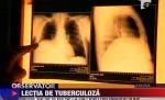 Braşov. Zeci de liceeni ar putea fi bolnavi de tuberculoză, din cauza unui profesor 