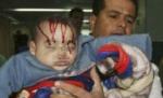 O copilărie traumatizată de bombardamentele din Gaza (Imagini şocante)