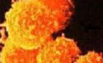 Evoluţie în combaterea tumorilor. Cercetătorii argentinieni au descoperit mecanismul de activare a sistemului imunitar