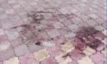 Moarte suspectă la Constanţa. O femeie s-a prăbuşit pe stradă, cu o rană în zona inimii (VIDEO)