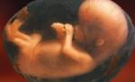 Medicii olandezi au dezvoltat un test de sânge pentru aflarea sexului fătului, la femeile însărcinate