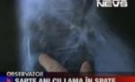 Un bărbat din Hunedoara trăieşte de şapte ani cu o lamă în spate (VIDEO)