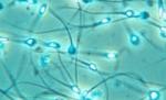Un test de fertilitate pentru bărbaţi va fi disponibil în curând pe piaţă 