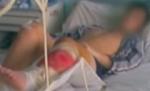 Un tânăr de 16 ani a rămas fără picior pentru că nu a fost operat la timp (VIDEO)