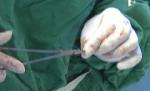 Domnul Cucu va suferi o operaţie de reconstrucţie a penisului, după ce şi l-a secţionat (VIDEO)