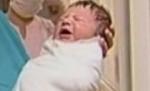 Un bebeluş de trei luni a suferit arsuri grave, după ce fratele i-a turnat var nestins peste faţă