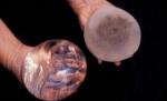 ?Silicoane? defecte, retrase de pe piaţă. 150 de românce, afectate (VIDEO)