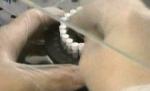 România rămâne fără vaccinul împotriva tuberculozei până la sfârşitul anului (VIDEO)