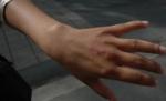 Consulul Cubei la Oslo a muşcat de mână o tânără în timpul unui protest (VIDEO)