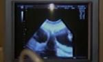 S-a născut cu două utere şi poartă câte o sarcină în fiecare - VIDEO