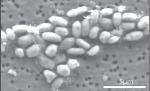 NASA anunţă existenţa unei bacterii care se hrăneşte cu arsenic: Va ajuta la descoperirea altor forme de viaţă