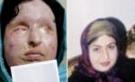Justiţie iraniană: O femeie orbită de soţ cu acid are dreptul la răzbunare