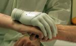 Mâna bionică, proteză de ultimă generaţie testată de un australian