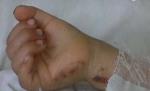Galaţi. Un copil de patru ani şi-a opărit fratele de trei ani