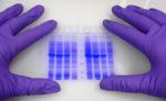 Bacteria E.coli, care a făcut 18 decese, foarte rezistentă la antibiotice