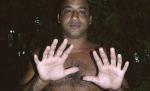 Un bărbat din Cuba are şase degete la fiecare mână şi la fiecare picior