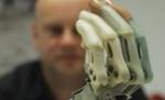 Un student din Iaşi a construit o mână bionică. Dispozitivul ajută şi la operaţii chirurgicale