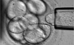 Milioane de oameni ar putea vedea din nou cu ajutorul celulelor stem. Un tratament experimental este testat la Londra