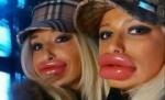 Piţipoanca e "emblemă", vrea botox-ul sus pe stemă! Vezi o galerie foto cu cele mai penibile transformări
