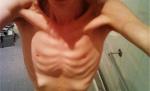 Voia să devină MODEL. A ajuns să cântărească 38 de kg la 16 ani, pentru că mânca o bucată de pâine pe zi