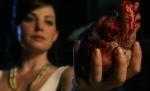 Au scăpat o inimă pe jos, la propriu. Păţania unor medici neîndemânatici