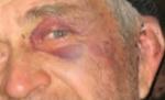 Bătrân bătut de doi jandarmi: Sunt gata să mor pentru tineret. Eu mi-am trăit viaţa