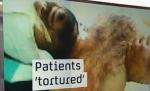 IMAGINI ŞOCANTE. Ororile din spitalele siriene. Pacienţii sunt torturaţi de doctorii care ar trebui să-i îngrijească
