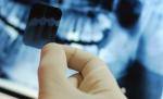 Studiul care a panicat lumea. Tumorile pe creier, provocate de o procedură medicală la care toţi am fost supuşi măcar o dată în viaţă