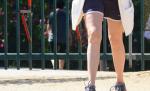 Cu pielea lăsată ca o bătrânică la 43 de ani