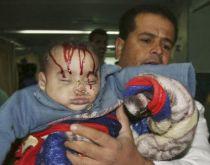 O copilărie traumatizată de bombardamentele din Gaza (Imagini şocante)