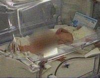 Braşov. Siamezii născuţi vara trecută dintr-o relaţie incestuoasă au murit 