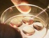 Ministerul Sănătăţii va aloca 500.000 euro pentru susţinerea cuplurilor care recurg la fertilizarea in vitro