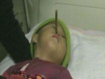 Un copil din China a supravieţuit 10 ore cu un beţigaş înfipt în creier