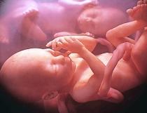 Tată pe jumătate: A aflat că numai unul din gemeni e copilul lui biologic