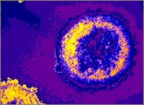 Studiu: Medicamentul împotriva herpesului prelungeşte viaţa pacienţilor infectaţi cu HIV