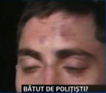 Un reşiţean susţine că a fost bătut de poliţişti pentru că a refuzat să facă o declaraţie (VIDEO)