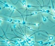 Un test de fertilitate pentru bărbaţi va fi disponibil în curând pe piaţă 
