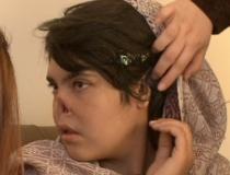 O fată din Afganistan a rămas fără nas şi urechi pentru că a fugit de la familia care o maltrata (FOTO)