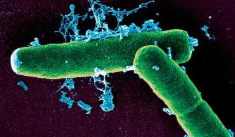 Bulgaria. Doi bărbaţi internaţi în urma unei infecţii cu antrax