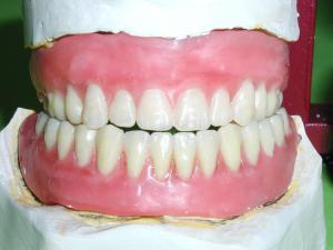 A jefuit o bancă pentru o proteză dentară