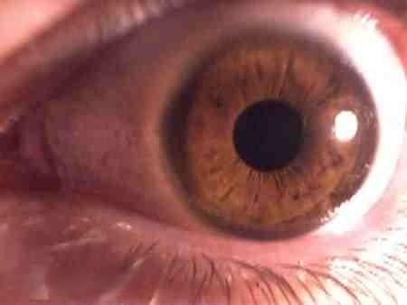 Boala secolului XXI pe care rişti să o ai, fără să ştii. 1 din 4 oameni suferă de ea. Adevărul te face să &icirc;ţi pierzi minţile