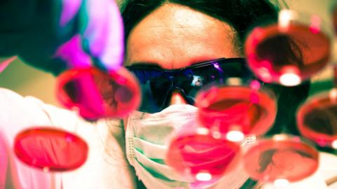 Descoperirea care ar putea trata şi preveni infecţia cu HIV: "Este o ţintă excelentă pentru medicamentele terapeutice"