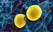 Bacteria MORTALĂ care bagă în sperieţi Europa! O poţi lua din AUTOBUZ sau tren şi îţi roade carnea
