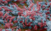 Insuccesul cercetătorilor se măsoară în pierderea a milioane de vieţi omeneşti. Acest vaccin nu a fost încă descoperit