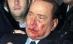 Silvio Berlusconi, cu nasul fracturat şi dinţii sparţi, după ce a fost lovit în faţă la Milano (VIDEO)