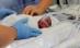 Miracol medical în Torino: A născut, deşi se afla în comă (VIDEO)