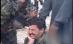 Un soldat îşi înfige mai multe cuţite în cap (IMAGINI ŞOCANTE)